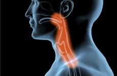 Опік горла — етіологія, методи діагностики та лікування