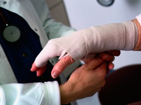 Перелом мізинця на руці зі зміщенням: терміни зрощення кістки, загальний прогноз реабілітаційного періоду