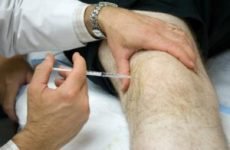 Укол для суглоба коліна при артрозі: назви ліків від болю