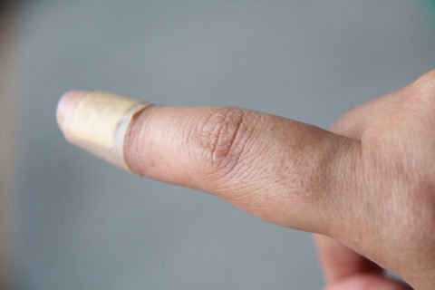 Як визначити перелом вказівного пальця руки — причини, симптоми і лікування