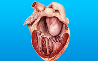 Симптоми пухлин серця