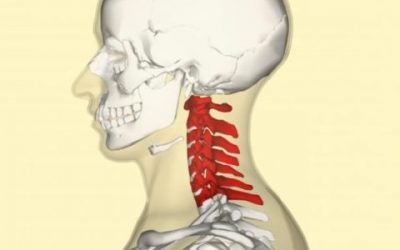 Перша допомога при переломі шийного відділу хребта: анатомічні особливості пошкодження, вимоги транспортування та первинного лікування, можливі наслідки та реабілітація