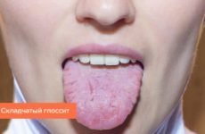Рана на язиці: як лікувати і чим, причини порізів мовою, ефективні препарати і народні засоби лікування мовних травм