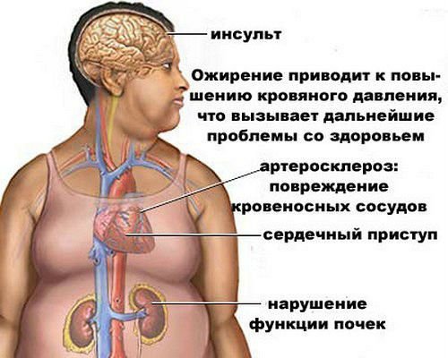 64af5a17e5ab33a85422da6e163d4ece