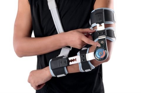 Як розробити руку після перелому: завдання, правила та комплекси ЛФК при травмах ліктя і переломі хірургічної шийки плеча