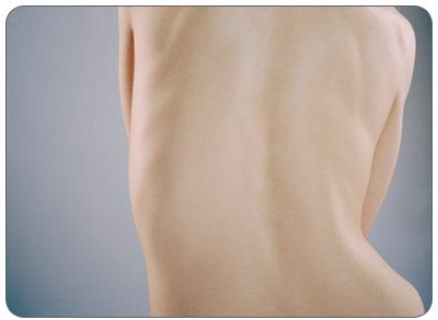 Симптоми перелому або тріщини ребра: характерні особливості та відмінності ушкоджень, їх діагностика і лікування
