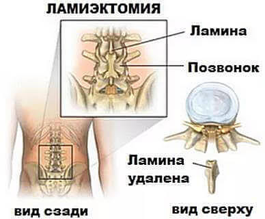 6d1a0ecb9d762fe95c508eeaa4556f58