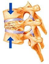 Як розпізнати патологічний компресійний перелом хребта, особливості травми, методи діагностики та лікування