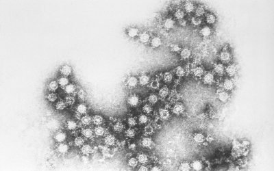 Вірус Коксакі у дитини: симптоми, види і лікування