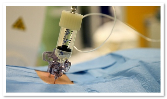 7671d5f50e6e832c789c1773b04b40e6