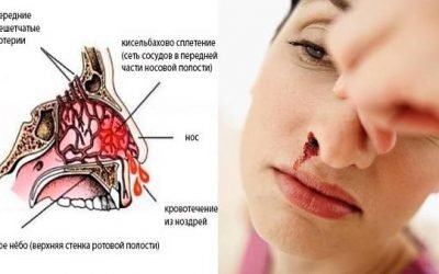Слабкі судини в носі: як зміцнити стінки судин