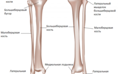 Велика гомілкова кістка: перелом виростків і межмыщелкового піднесення великогомілкової кістки, терміни лікування