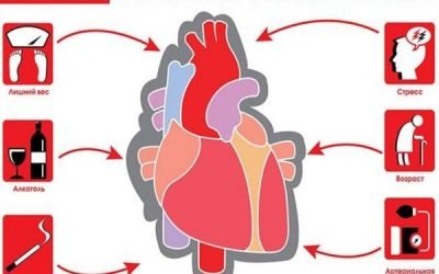 Профілактика інфаркту міокарда: як запобігти інфаркт