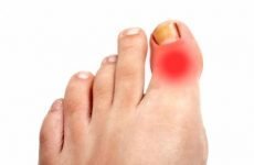 Як визначити перелом пальця на нозі — симптоми і методи діагностики