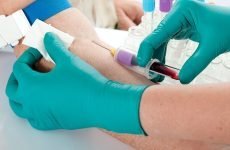 Переливання крові при низькому гемоглобіні: особливості та наслідки