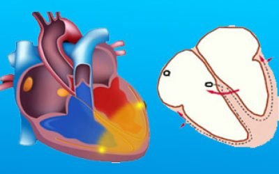 Все про блокадах серця: симптоми, лікування патології 1, 2, 3 ступеня