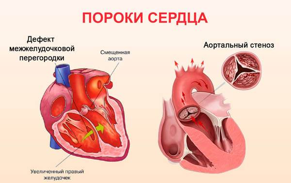 941ec8dbb581698233fc26fe94599e6d