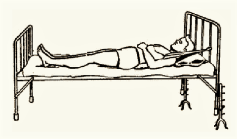 ЛФК при переломі грудного відділу хребта: форми, завдання, правила, приклади базових комплексів гімнастичних вправ