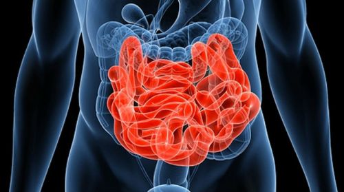 Захворювання тонкого кишечника: симптоми і лікування хвороб тонкої кишки