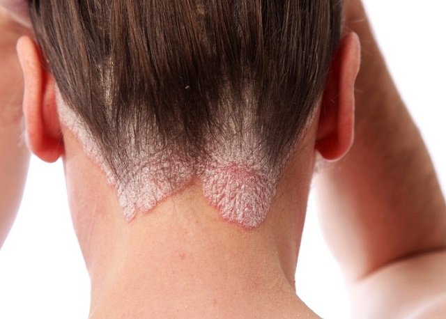 aa52e30e0ab223cd2ea6ff7ac10cc64d