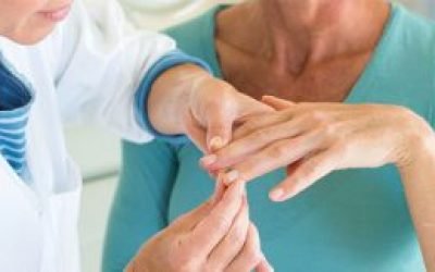 Псоріаз на руках: причини і лікування. Як і чим лікувати псоріаз на пальцях рук
