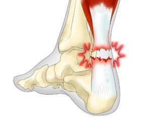Будова ноги нижче коліна: картинки кісток і мязів гомілки у людини