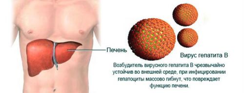 Гепатит B: симптоми, лікується хвороба чи ні, лікування, характерні ознаки