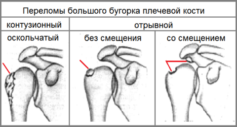 b07275295c35489621235eff13db0d12
