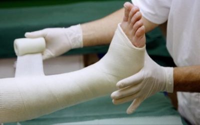 Як проводиться лікування перелому ноги, класифікація травм, реабілітація