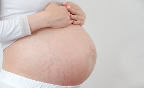 Атопічний дерматит при вагітності: лікування і причини