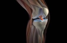 Будова коліна – колінного суглоба людини: зв’язки і м’язи ноги, фото і картинки