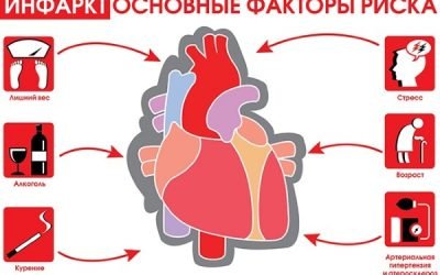 Інфаркт задньої стінки серця: наслідки, лікування та реабілітація