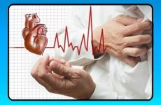 Лікування аритмії серця народними засобами і симптоми прояву