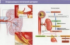 Причини розвитку і способи лікування тромбозу ниркових вен