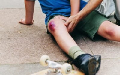 Мазь при ударах і травмах ноги, руки, знеболюючі мазі після травм коліна