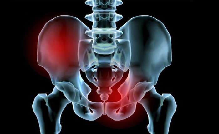 Перелом лонної кістки тазу: чим небезпечний, терміни реабілітації
