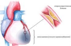 Як відрізнити біль у серці від невралгії: 7 головних відмінностей