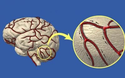 Як зміцнити судини головного мозку: препаратами і народними засобами