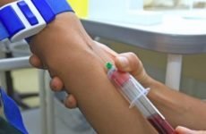 Що означає обстеження крові на HBSAG?