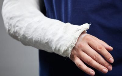Як визначити перелом руки за зовнішніми ознаками і на рентгені