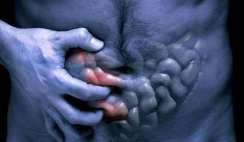 Хвороба Крона: симптоми і лікування товстої кишки, як лікувати, причини, ознаки