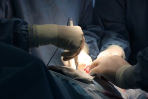 Заміна тазостегнового суглоба: реабілітація після операції і її терміни