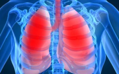 Набряк легенів: симптоми у літніх людей, ознаки, невідкладна допомога, лікування дорослих