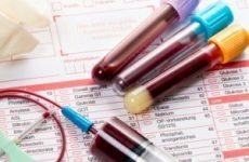 АЦЦП – аналіз крові: розшифровка, норма у дорослих, що показує?