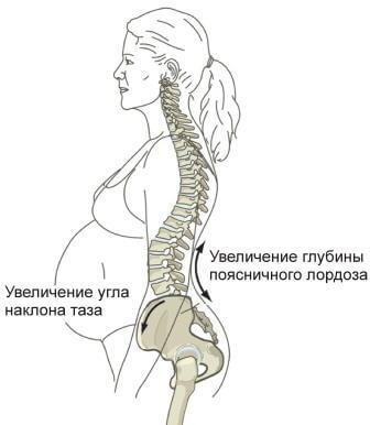 3 кращих методу діагностики поперекового остеохондрозу 31 f904ae66705c9c2b6b29497224188bc9