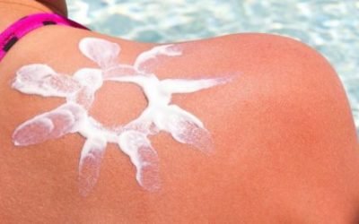 Чим викликаний сонячний опік шкіри і його методи лікування