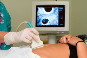 Лікування позаматкової вагітності: що роблять, як усувають, обовязковий аборт? Скільки лежати в лікарні і може вагітність вийти сама?