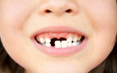 Коли випадають молочні зуби у дітей: терміни, послідовність і схема