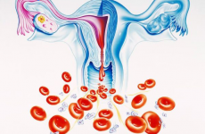 Виділення при позаматкової вагітності: які бувають на ранніх термінах і може бути позаматкова вагітність без кров’янистих виділень