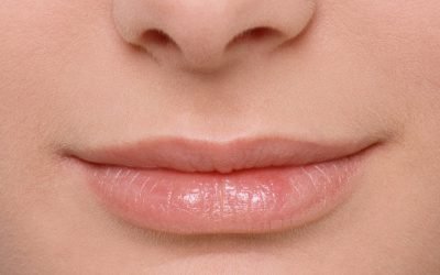 Опухла верхня губа: причини і методи лікування набряку
